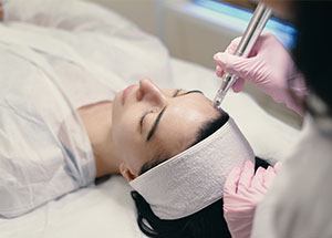 Microneedling
